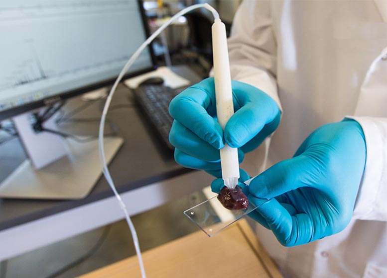 用“ Masspec Pen”手術過程中的準確癌症檢測