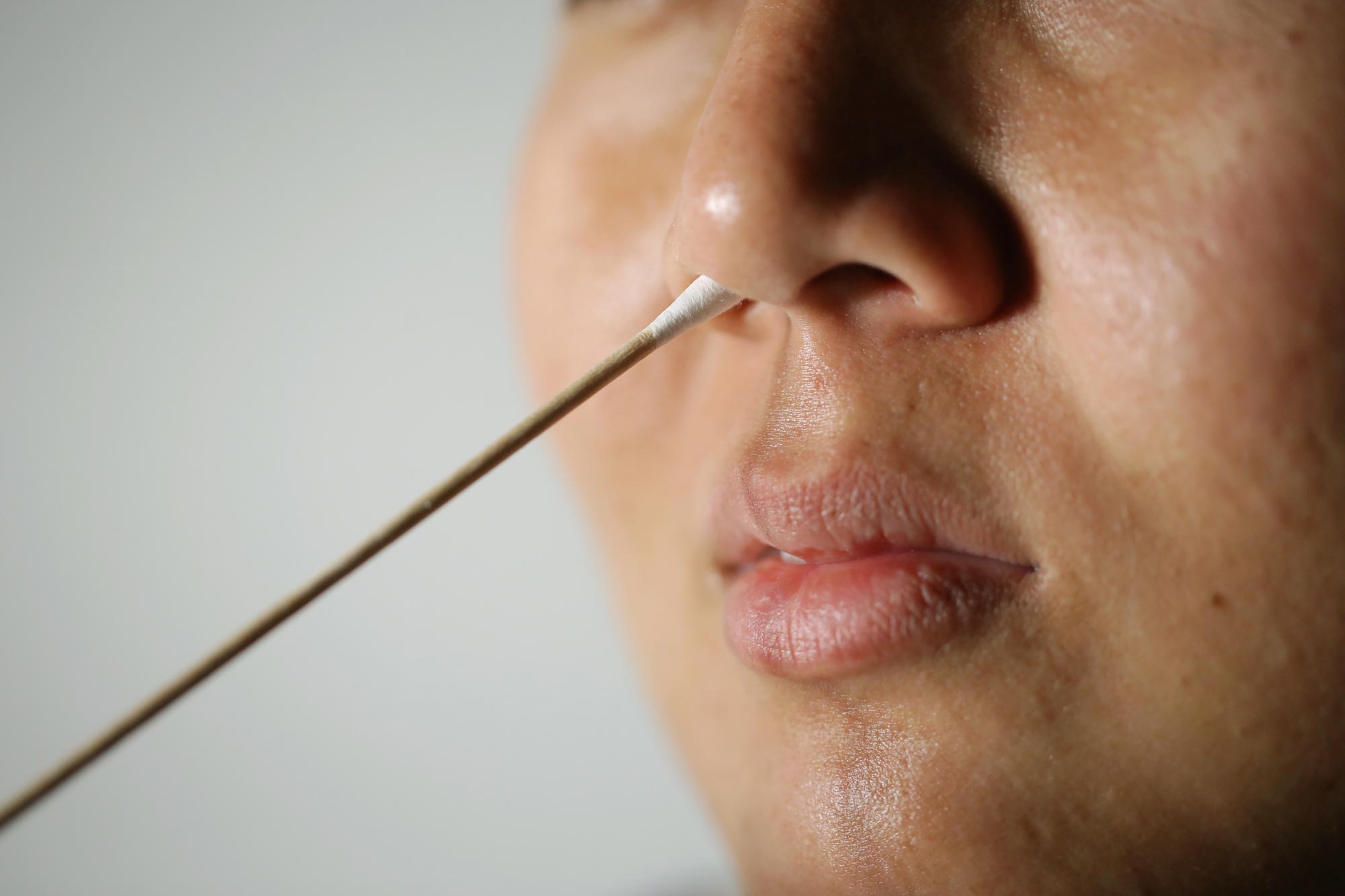 簡單的鼻拭子可以在症狀出現前數年檢測出阿茲海默症